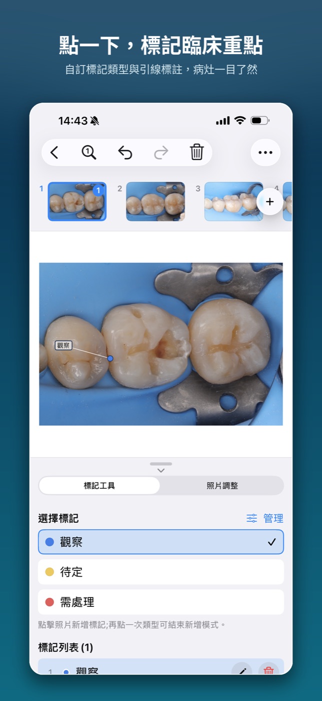 iPhone 畫面 — 臨床照片標記