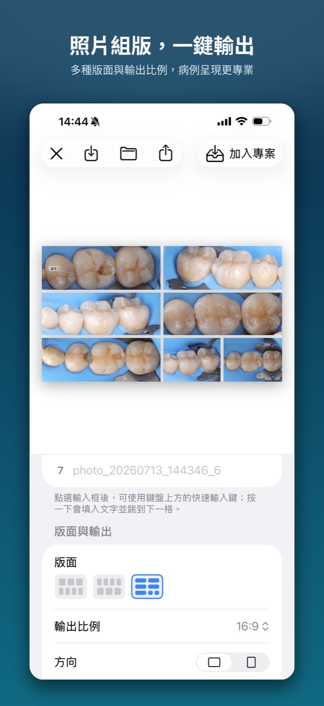 iPhone 畫面 — 專案與照片管理