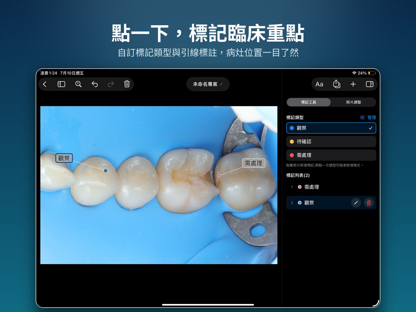 Case Marker Pro — 點一下,標記臨床重點