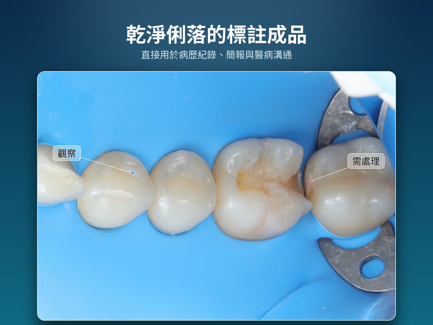 標註成品 — 乾淨俐落的標註成品